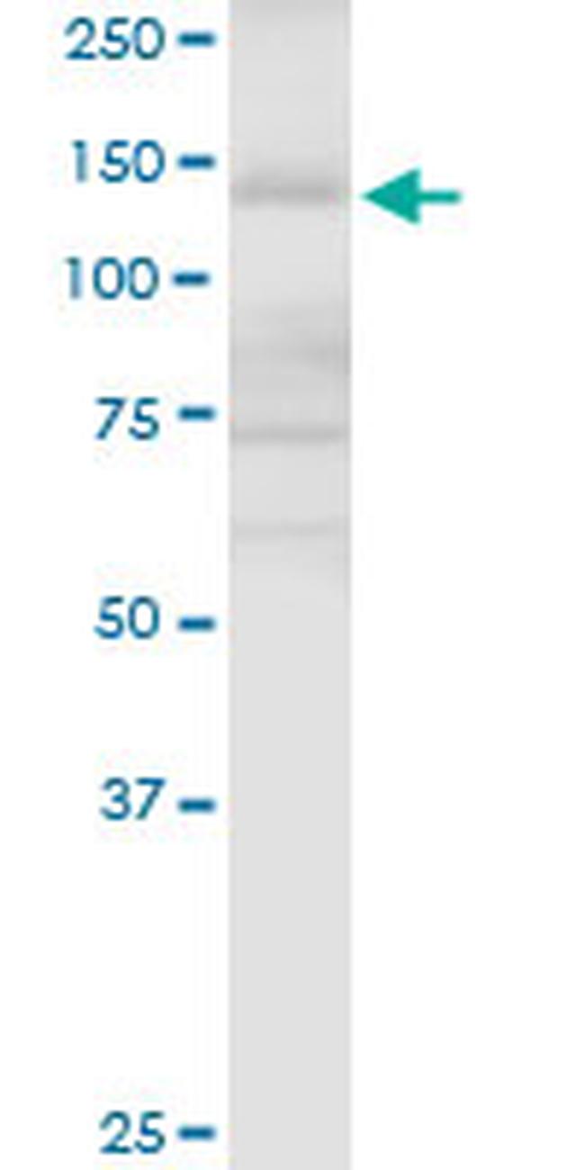 APAF1 Antibody in Western Blot (WB)