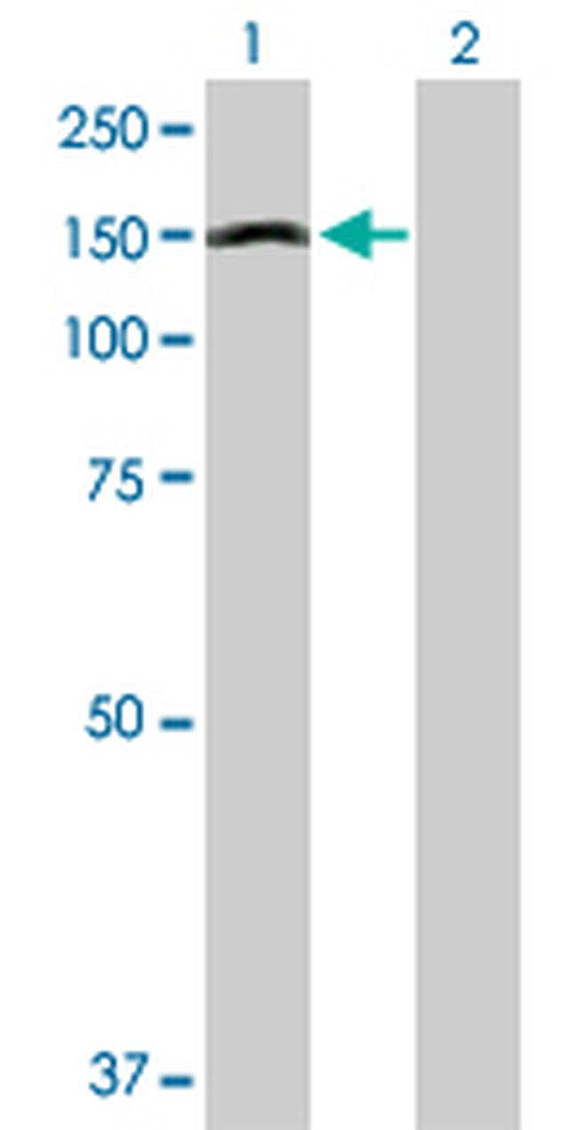 APAF1 Antibody in Western Blot (WB)