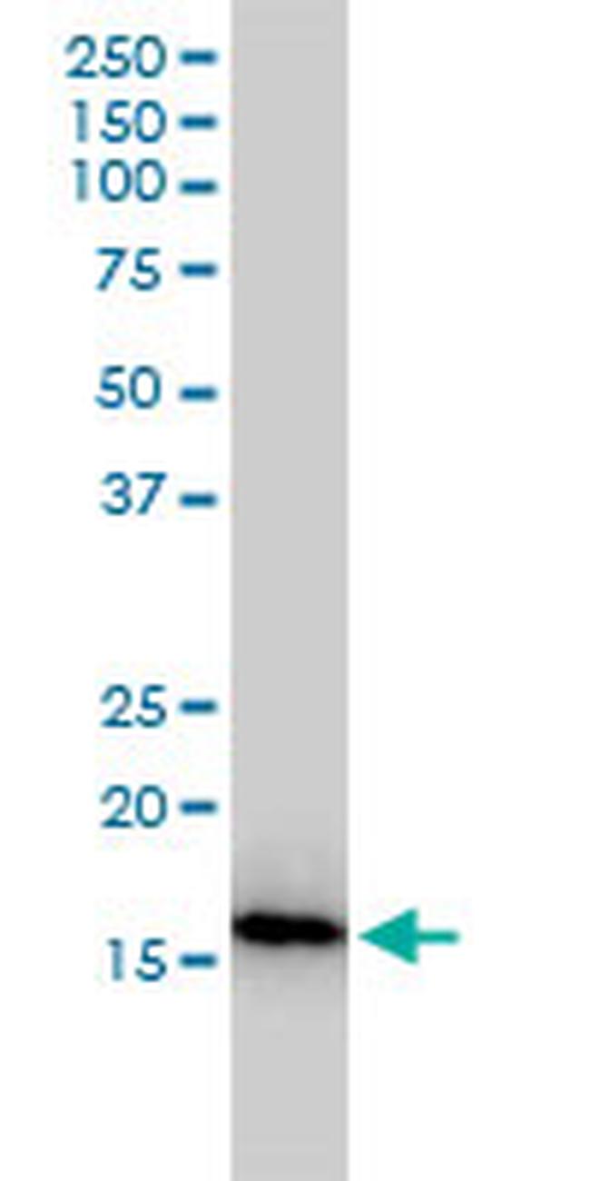 NUDT2 Antibody in Western Blot (WB)