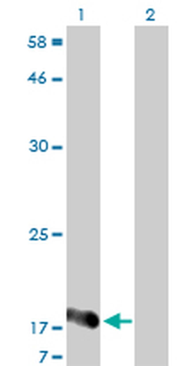 NUDT2 Antibody in Western Blot (WB)