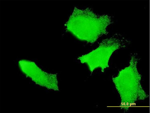 APC Antibody in Immunocytochemistry (ICC/IF)