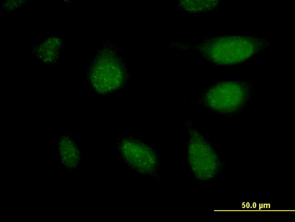 APCS Antibody in Immunocytochemistry (ICC/IF)