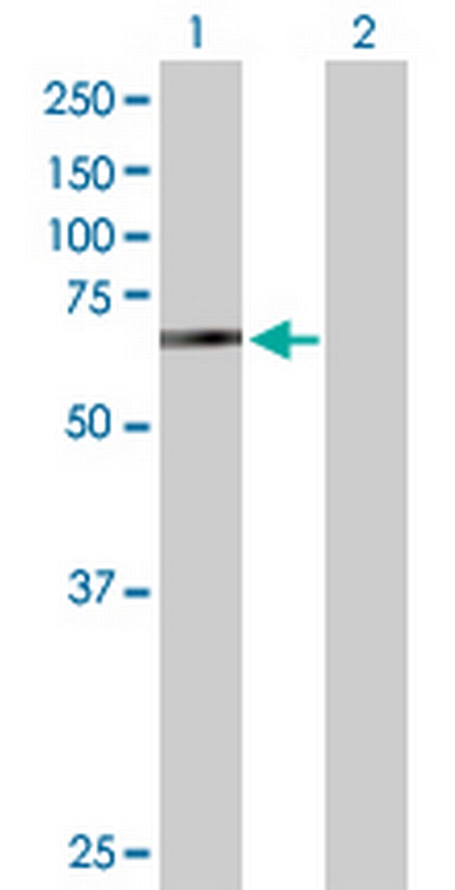 BIRC2 Antibody in Western Blot (WB)