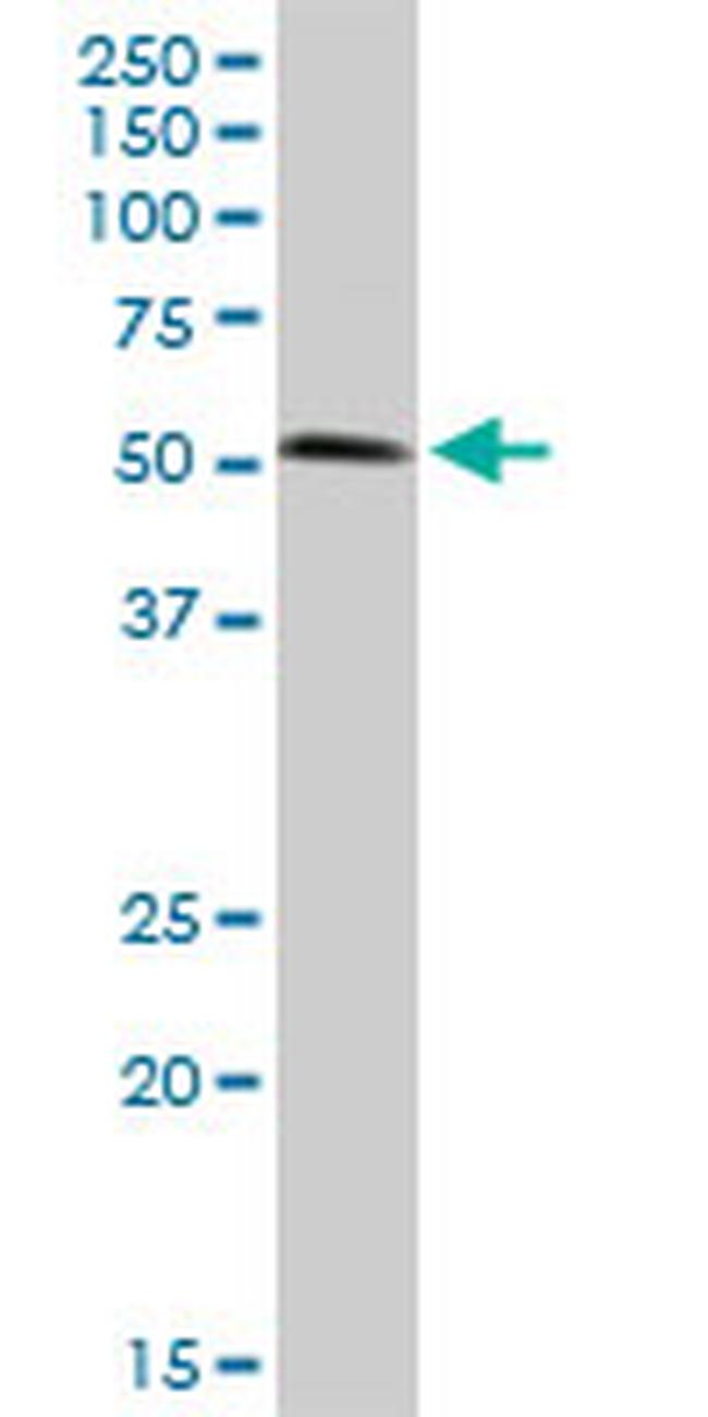 BIRC4 Antibody in Western Blot (WB)