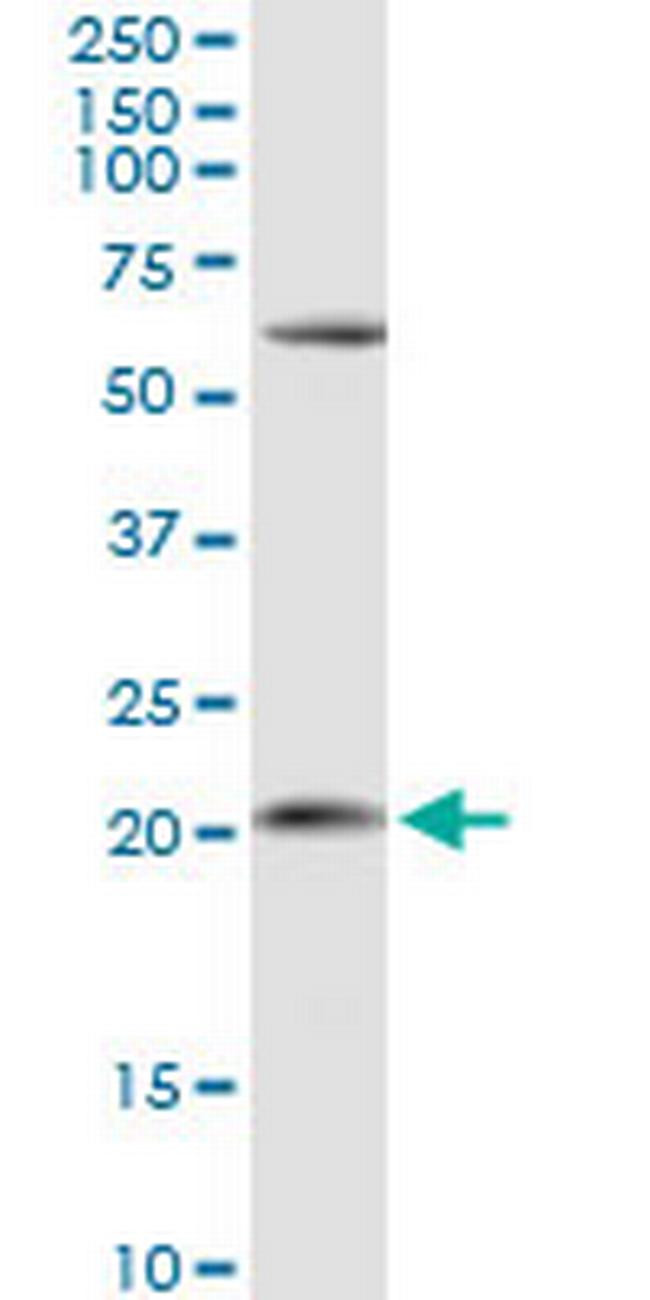 APRT Antibody in Western Blot (WB)