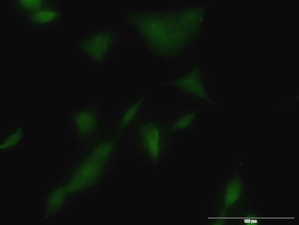 KLK3 Antibody in Immunocytochemistry (ICC/IF)