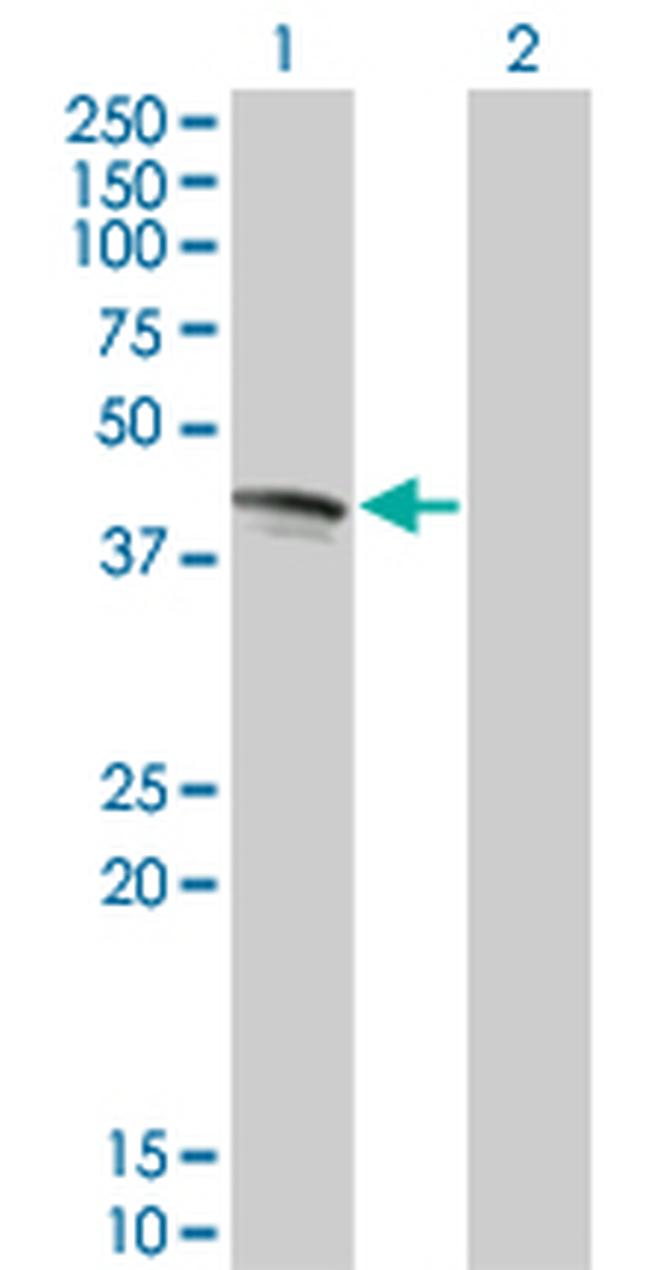 FAS Antibody in Western Blot (WB)