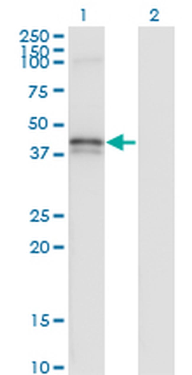 FAS Antibody in Western Blot (WB)