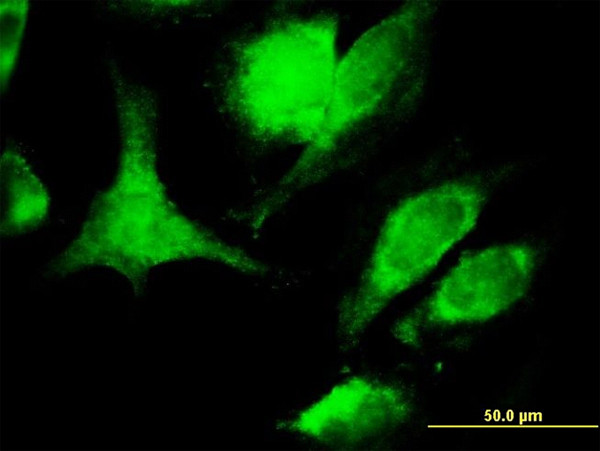 FASLG Antibody in Immunocytochemistry (ICC/IF)