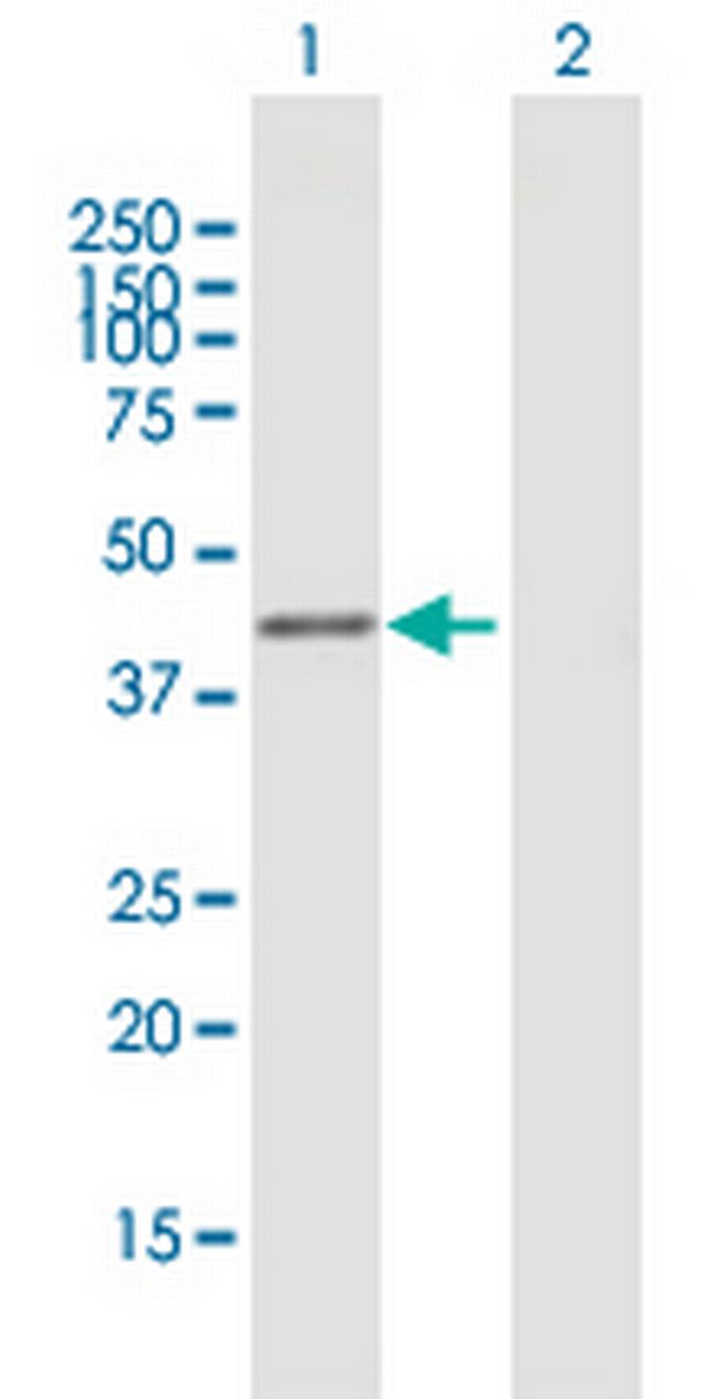 AREG Antibody in Western Blot (WB)