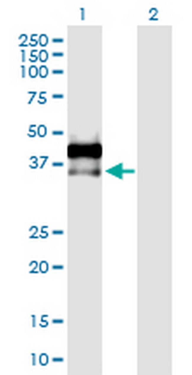 AREG Antibody in Western Blot (WB)