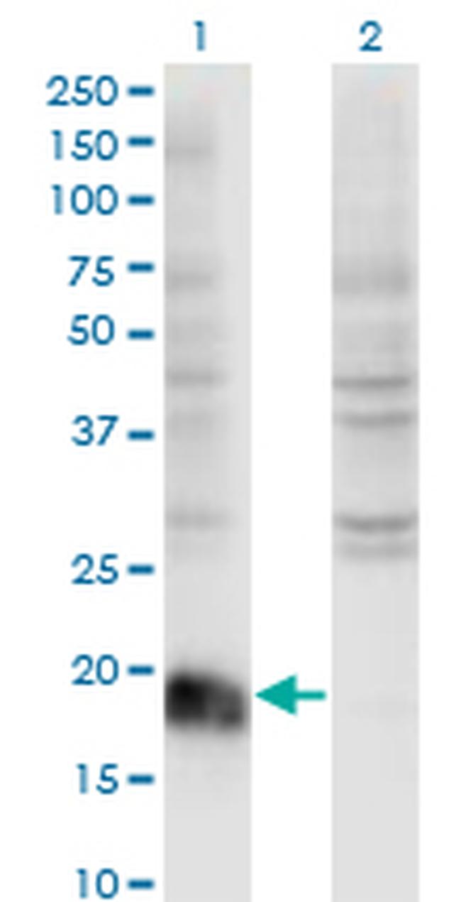 ARF6 Antibody in Western Blot (WB)