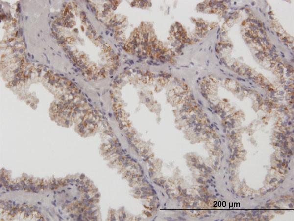 ARG2 Antibody in Immunohistochemistry (Paraffin) (IHC (P))