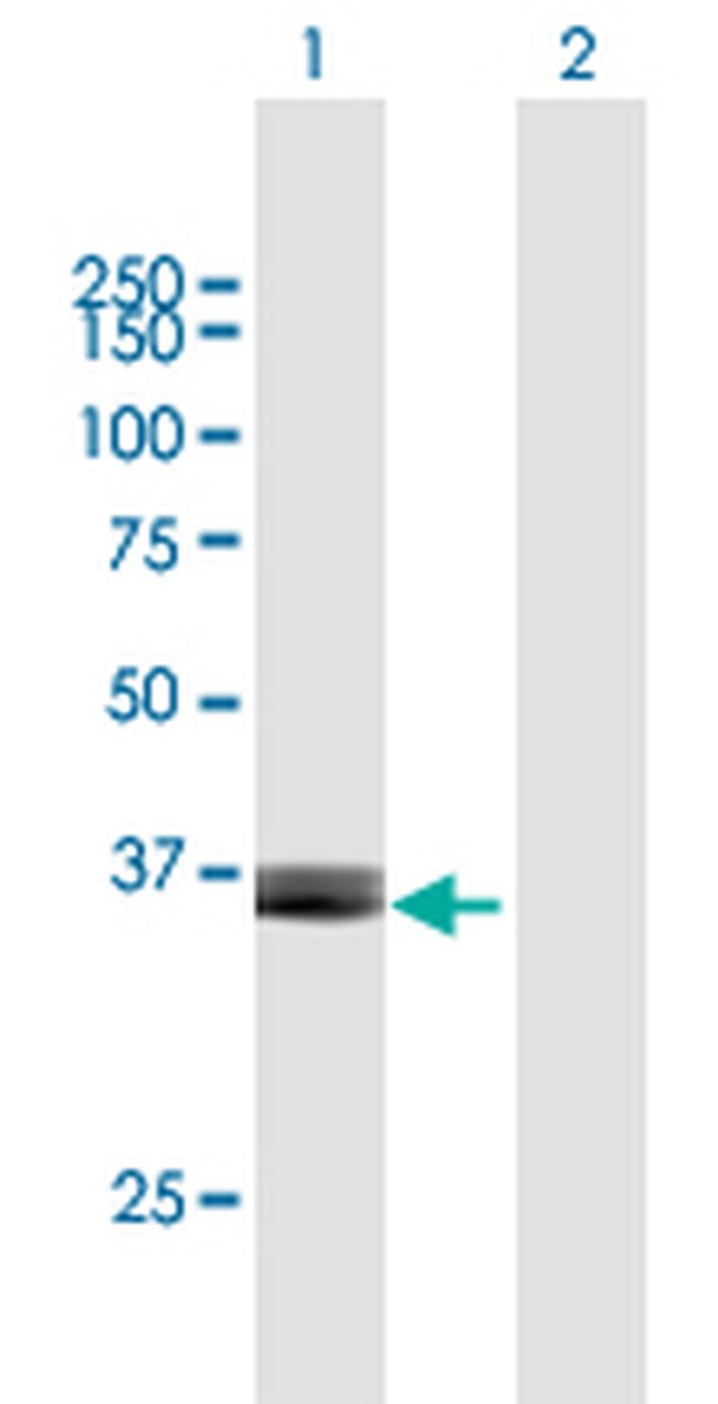 ARG2 Antibody in Western Blot (WB)