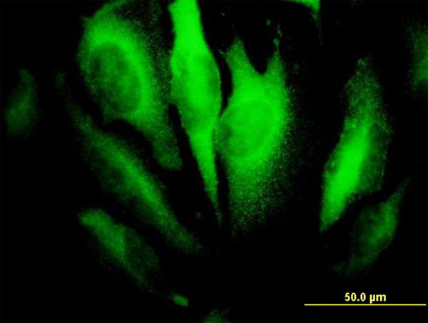 RHOA Antibody in Immunocytochemistry (ICC/IF)