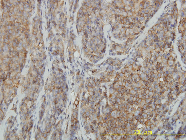 RHOA Antibody in Immunohistochemistry (Paraffin) (IHC (P))