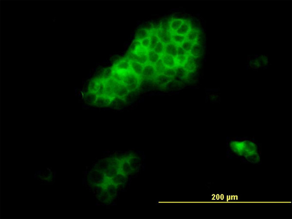 RHOA Antibody in Immunocytochemistry (ICC/IF)