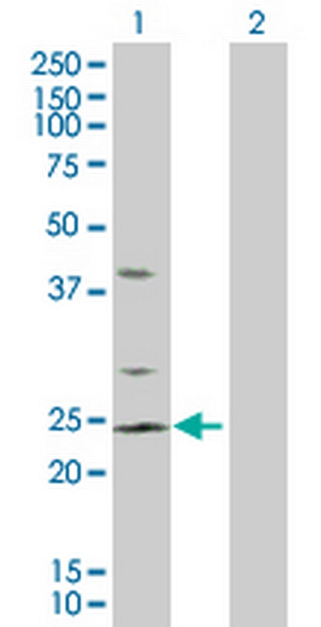 RHOC Antibody in Western Blot (WB)