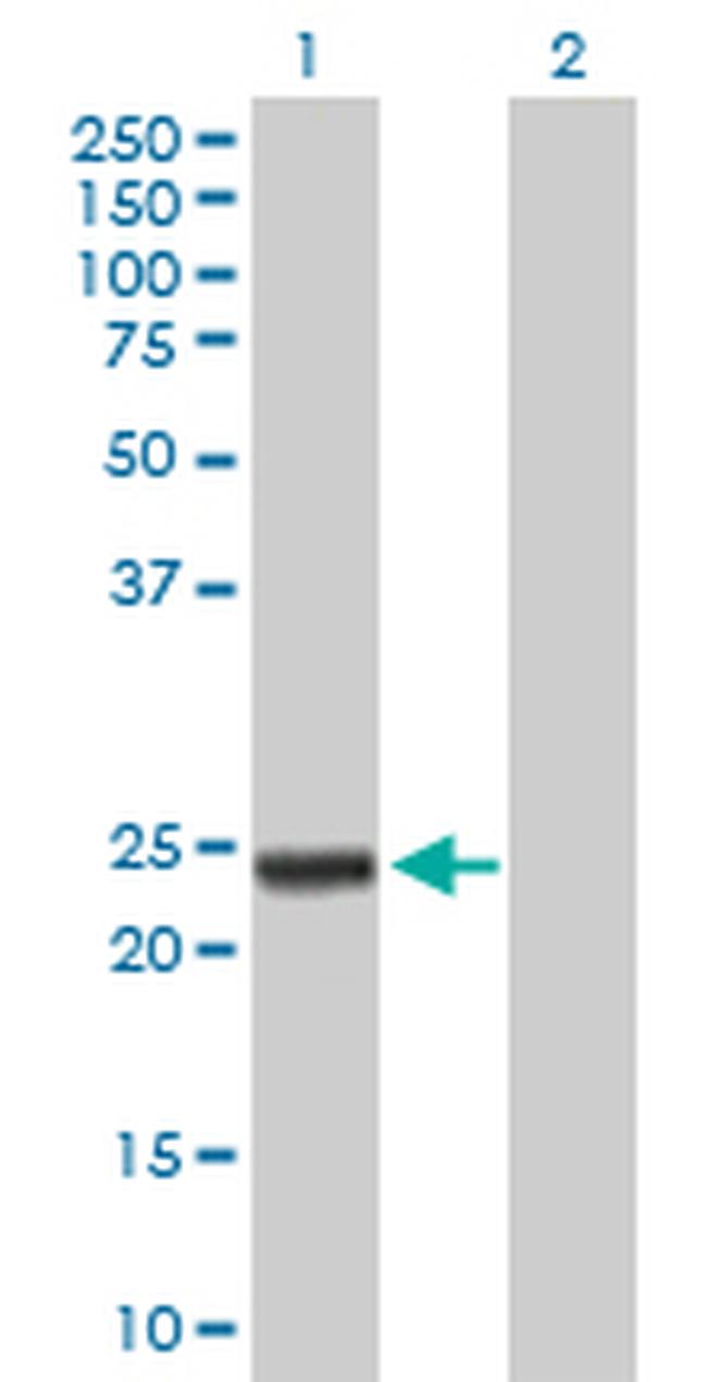 ARHGDIA Antibody in Western Blot (WB)