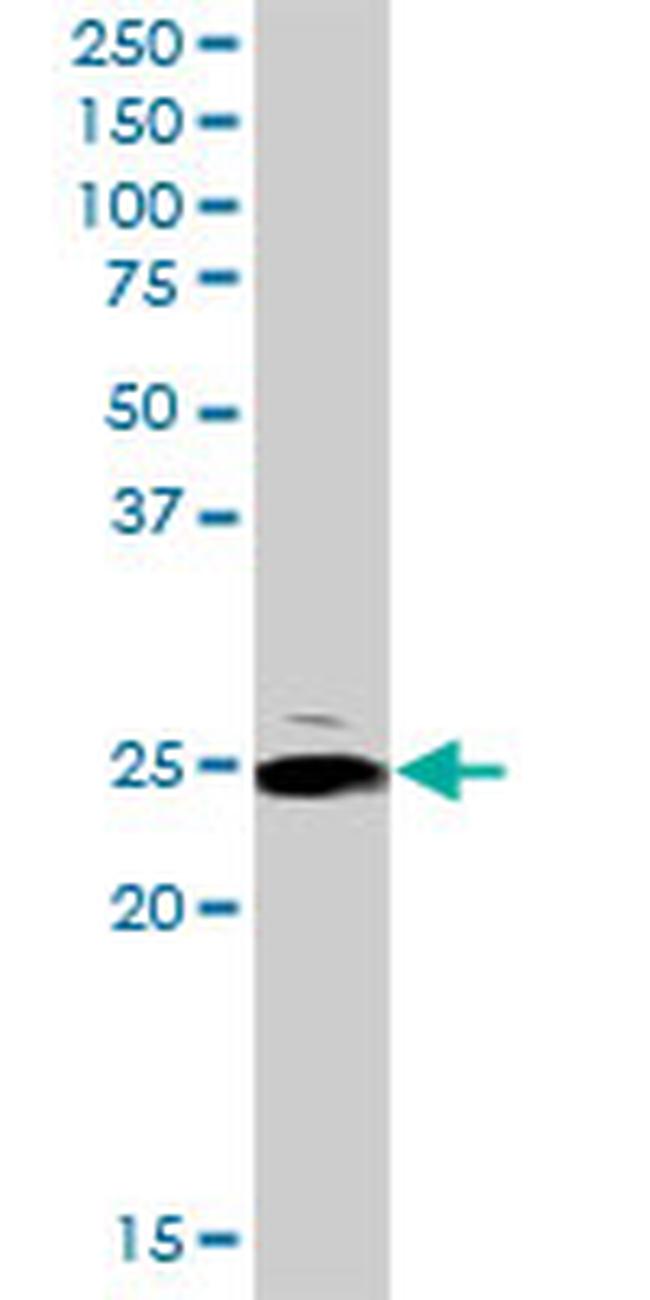 ARHGDIA Antibody in Western Blot (WB)