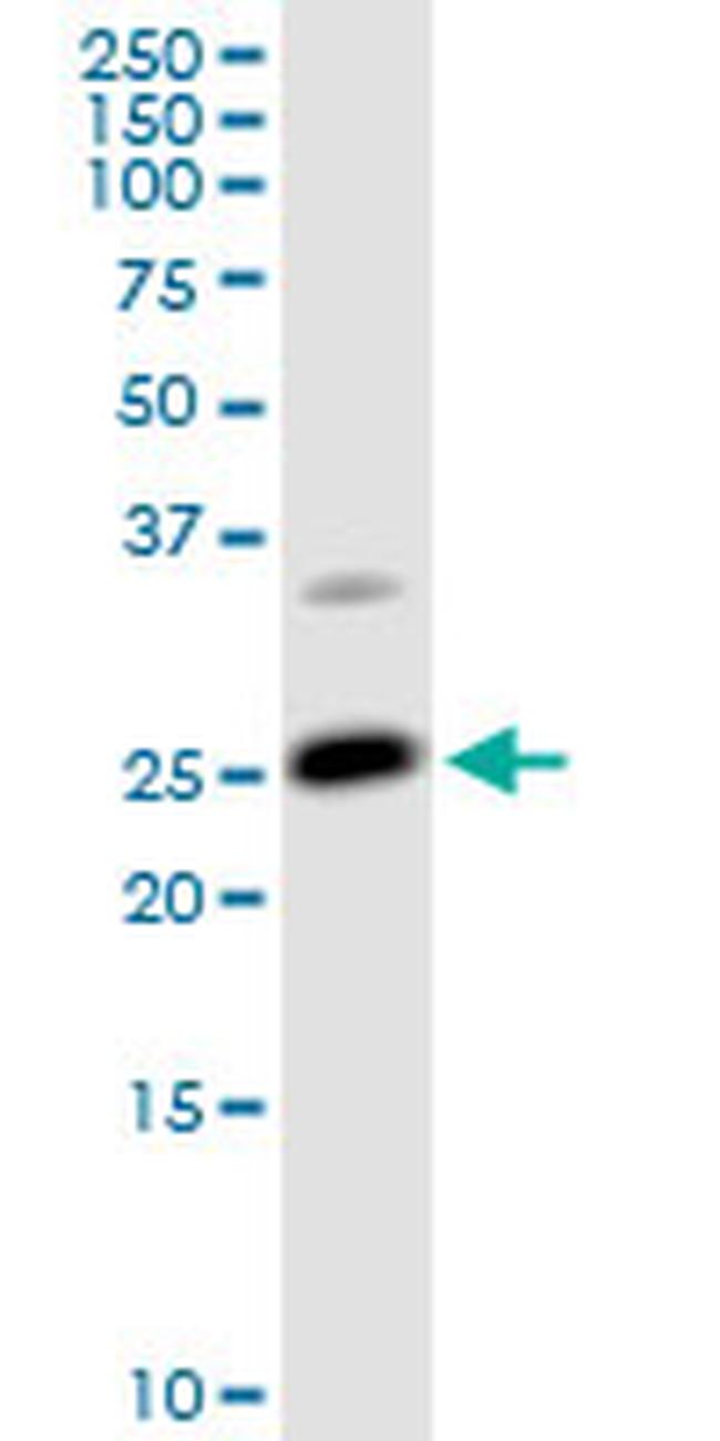 ARHGDIA Antibody in Western Blot (WB)