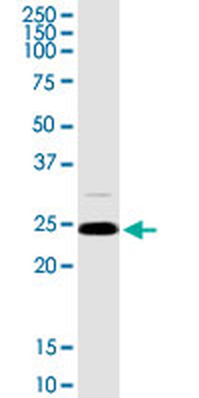 ARHGDIA Antibody in Western Blot (WB)