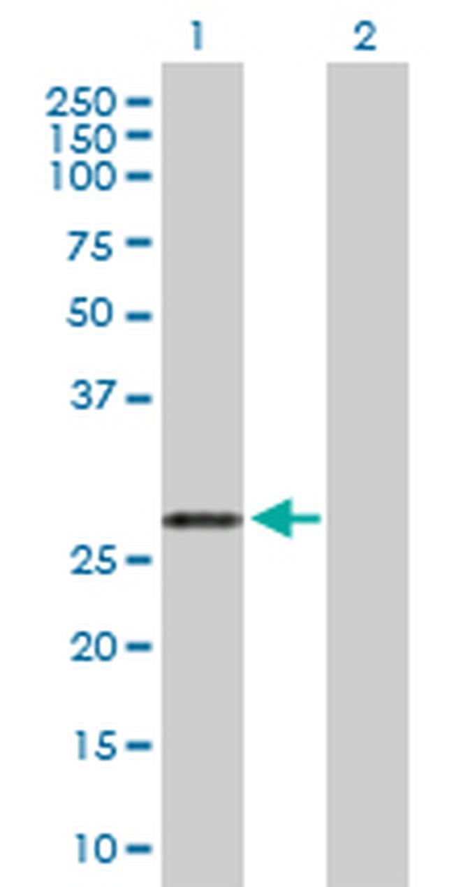 ARHGDIA Antibody in Western Blot (WB)