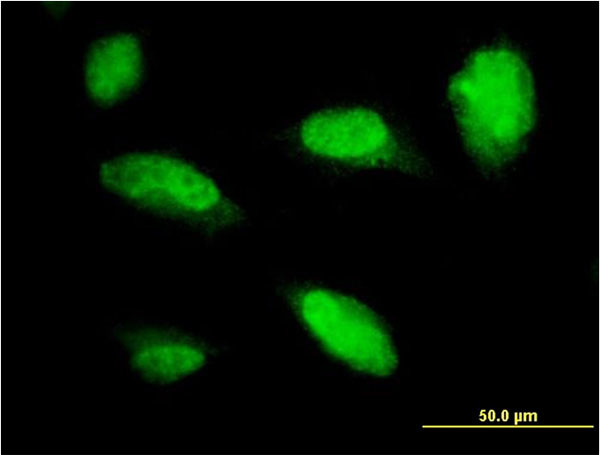 PHOX2A Antibody in Immunocytochemistry (ICC/IF)