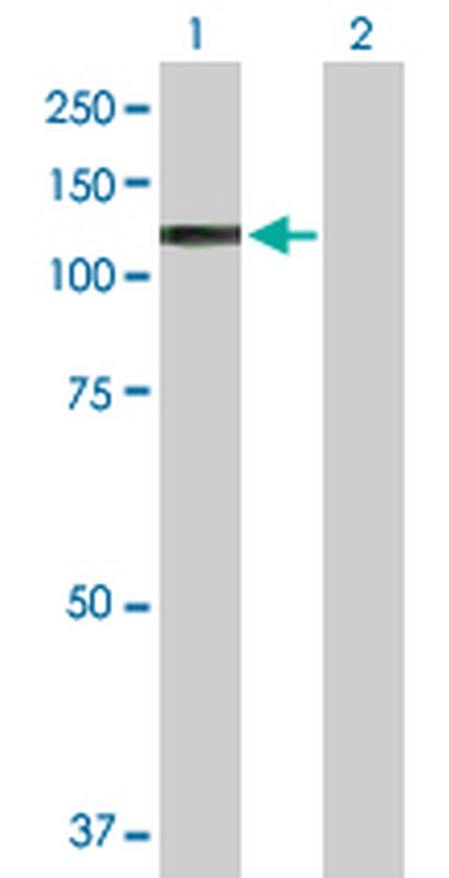 ARNT Antibody in Western Blot (WB)