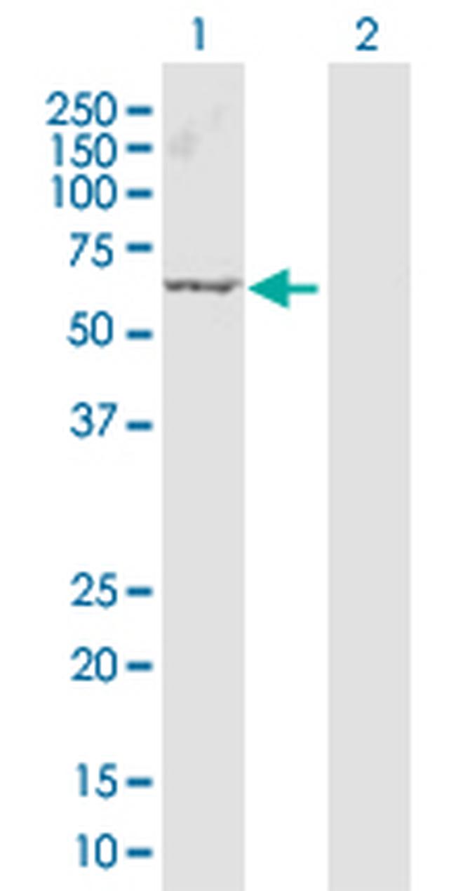 ARRB1 Antibody in Western Blot (WB)