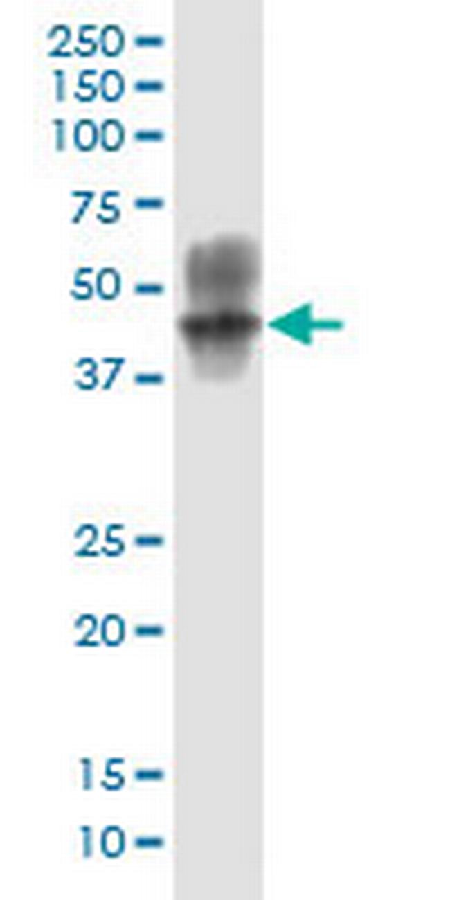 ARRB2 Antibody in Western Blot (WB)