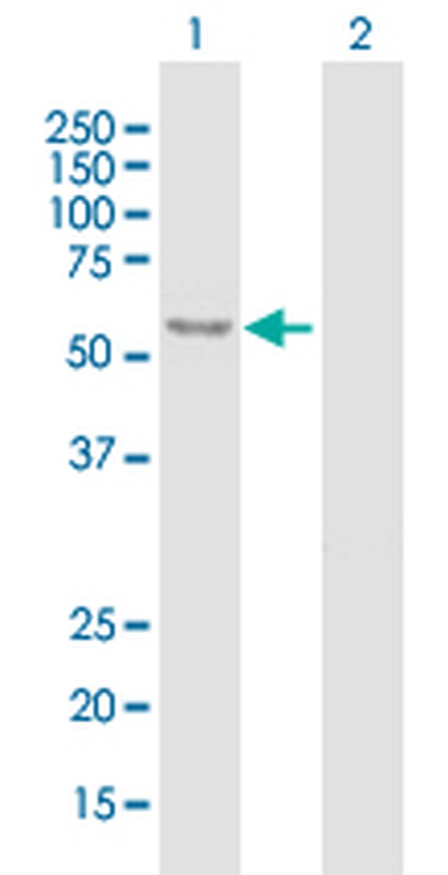 ARSA Antibody in Western Blot (WB)