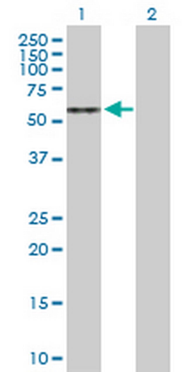 ARSA Antibody in Western Blot (WB)