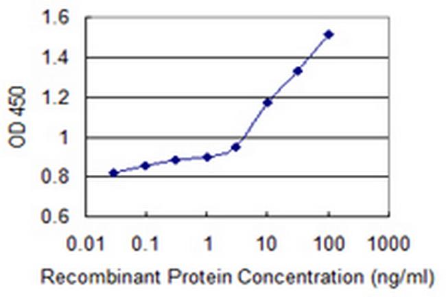 ARSB Antibody in ELISA (ELISA)