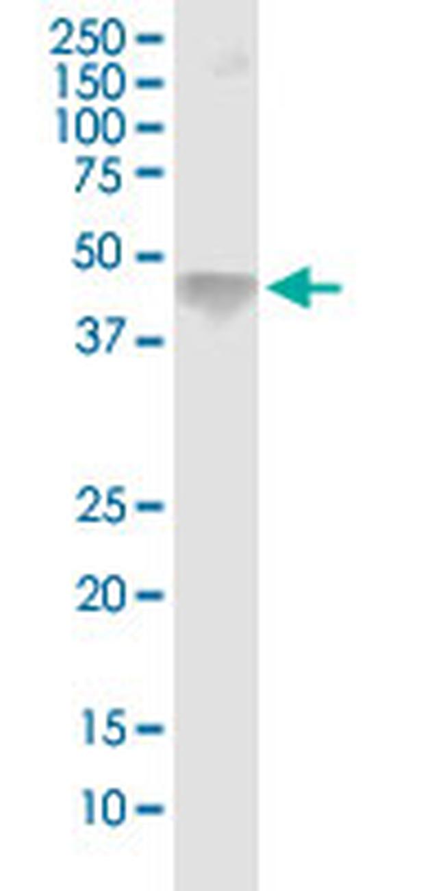 ASGR1 Antibody in Western Blot (WB)