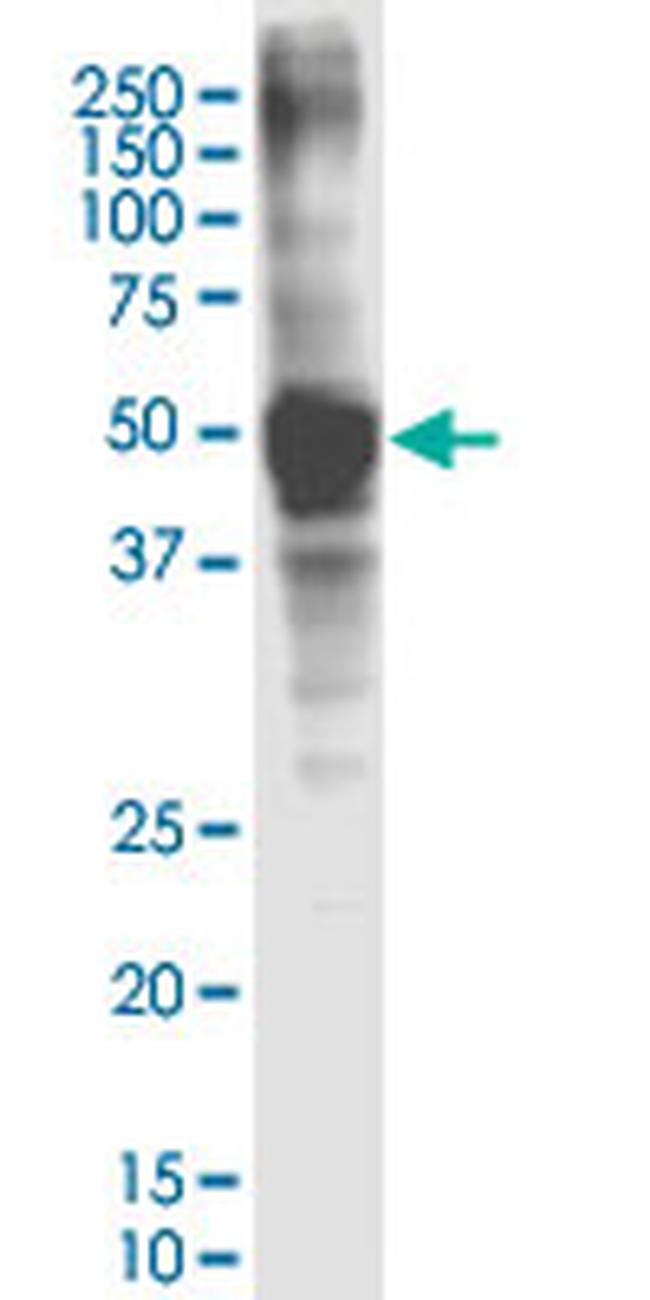 ASGR1 Antibody in Western Blot (WB)