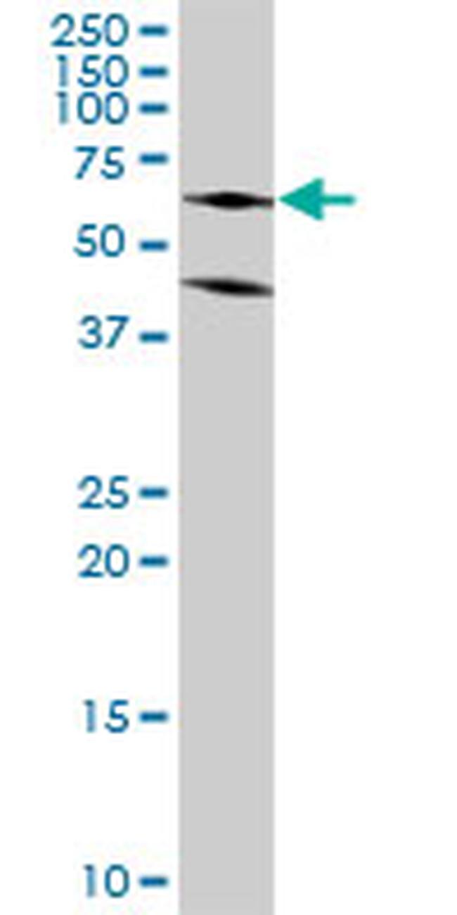 ASL Antibody in Western Blot (WB)