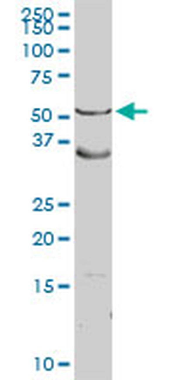 ASL Antibody in Western Blot (WB)