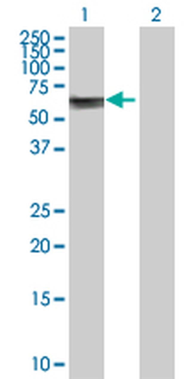 ASNS Antibody in Western Blot (WB)