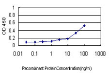 ASNS Antibody in ELISA (ELISA)