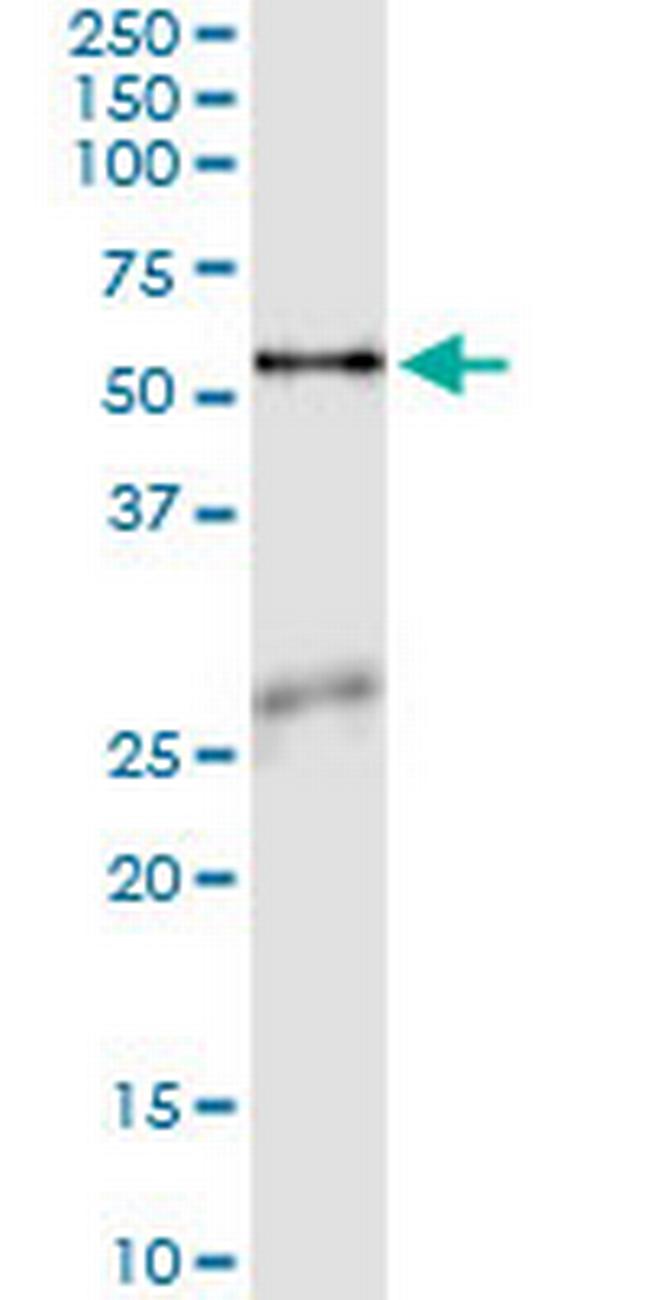 ASNS Antibody in Immunoprecipitation (IP)