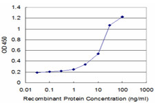 ASPH Antibody in ELISA (ELISA)