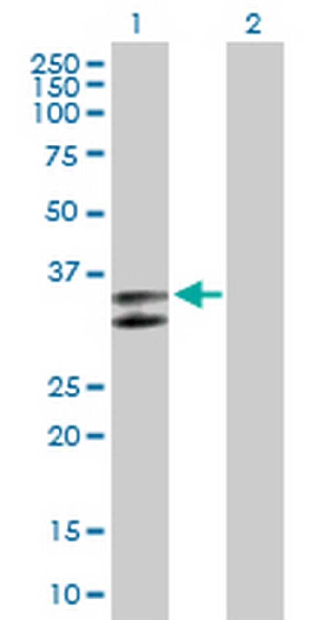 SERPINC1 Antibody in Western Blot (WB)