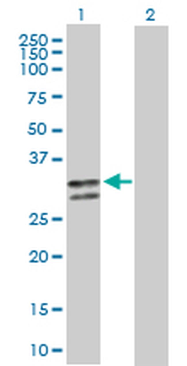 SERPINC1 Antibody in Western Blot (WB)