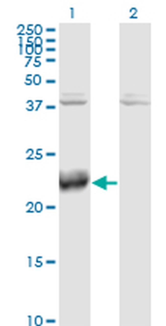 ATF3 Antibody in Western Blot (WB)