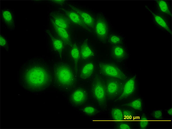 ATF4 Antibody in Immunocytochemistry (ICC/IF)