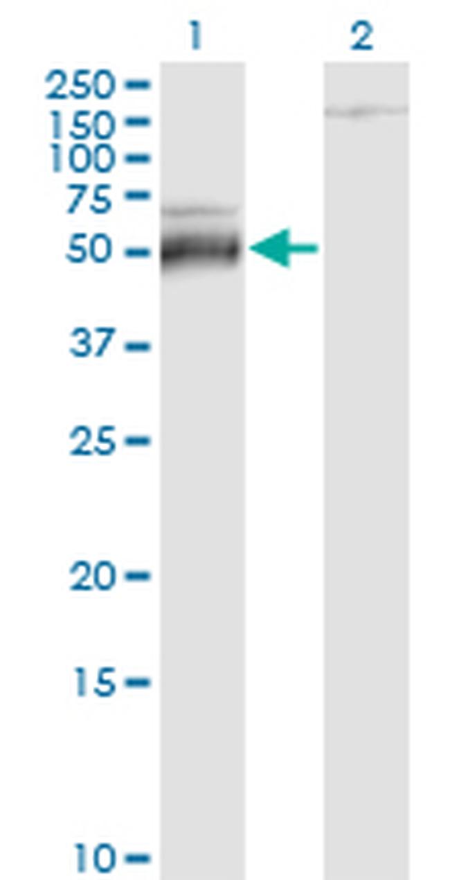 ATF4 Antibody in Western Blot (WB)