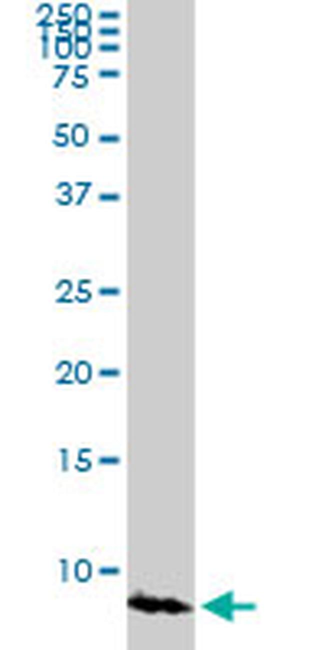 ATOX1 Antibody in Western Blot (WB)