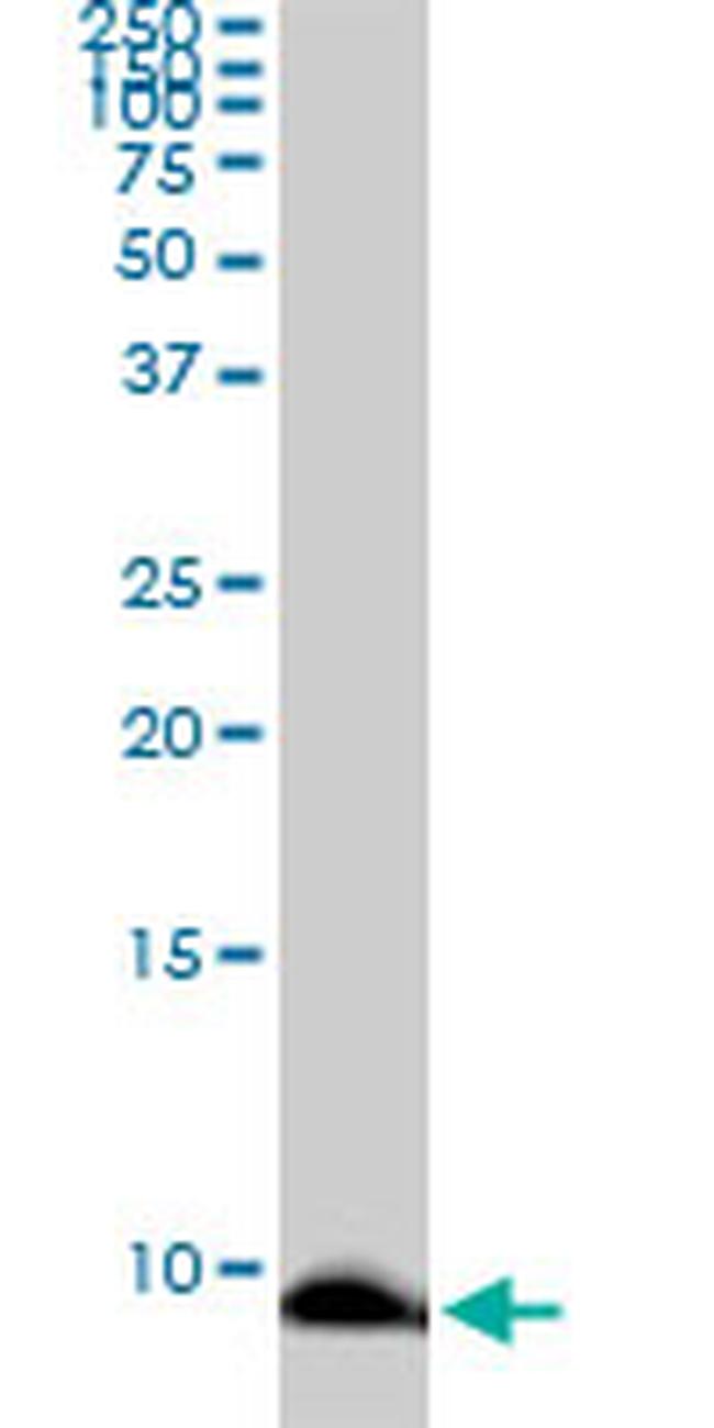 ATOX1 Antibody in Western Blot (WB)