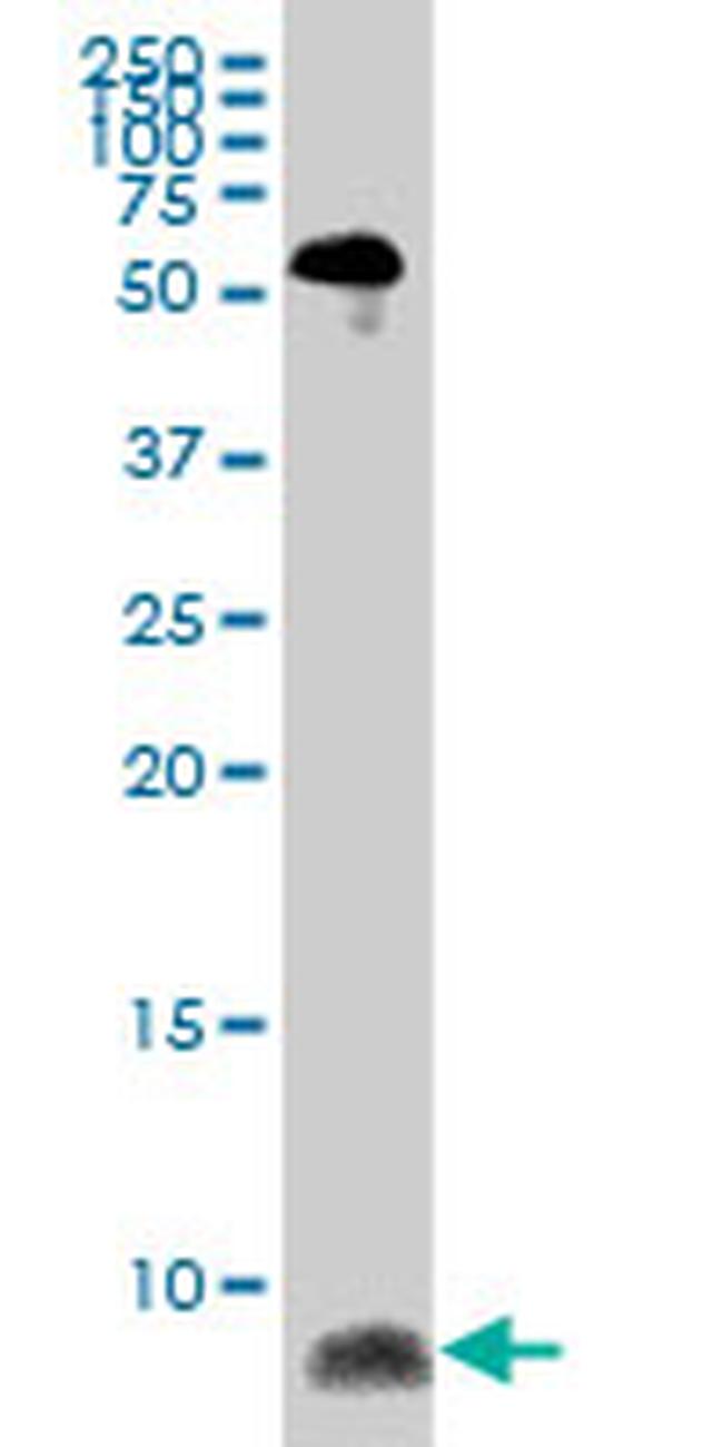 ATOX1 Antibody in Western Blot (WB)